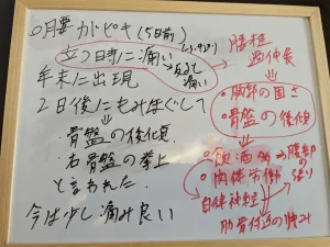 腰痛の原因も説明